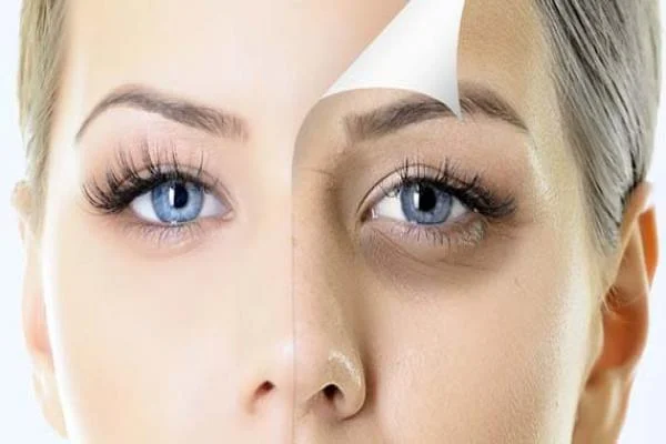 Dark Under Eye Treatment in Wagholi Pune